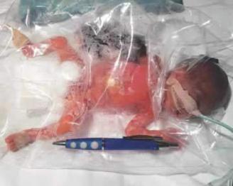 FB_IMG_1490295806427